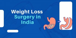 Bariatric Weight loss