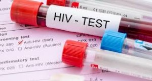 Global HIV-AIDS Diagnostics Market by 2024: Share, Size, Challenges and opportunities.