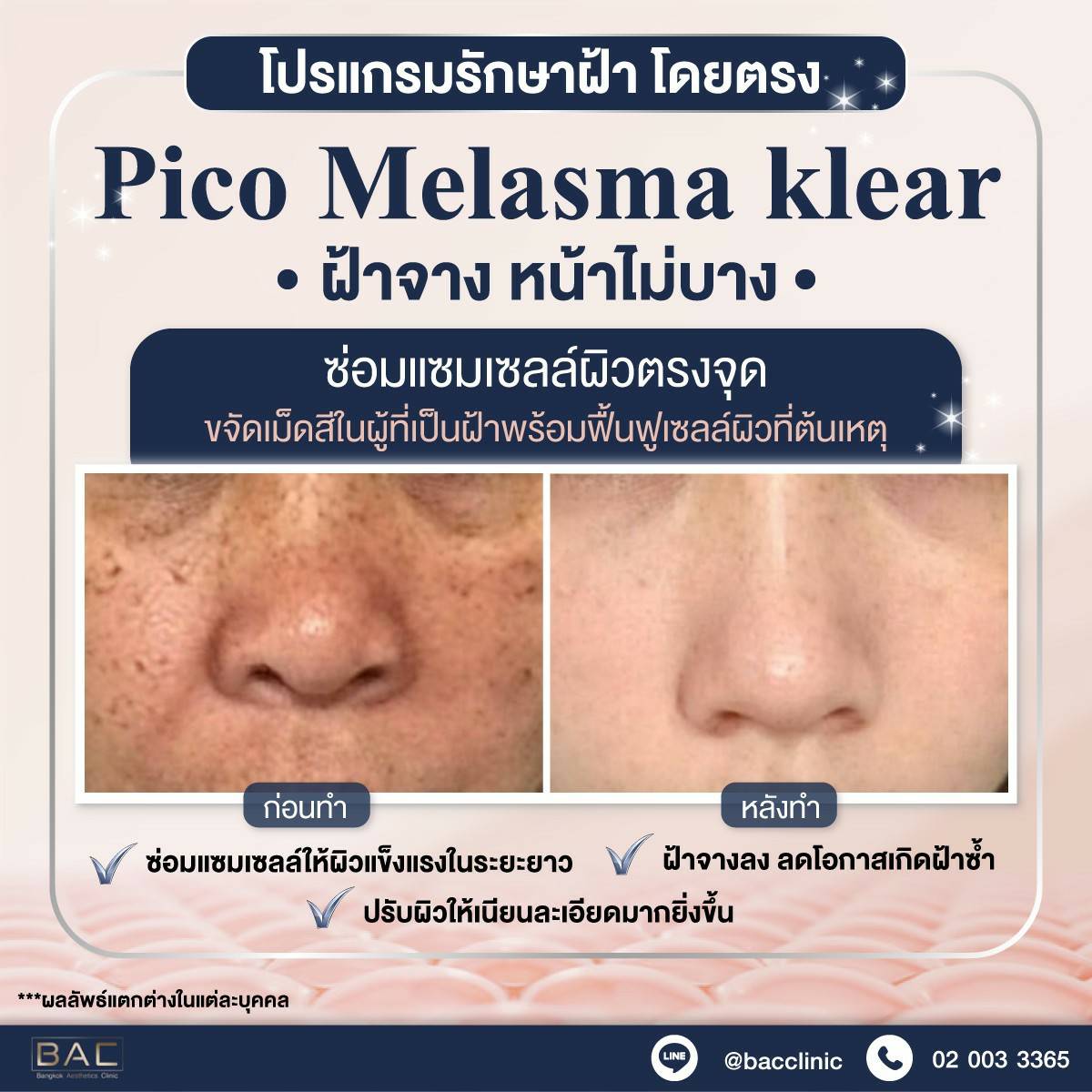 BAC Clinic