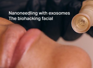 nanoneedling with exosomes
