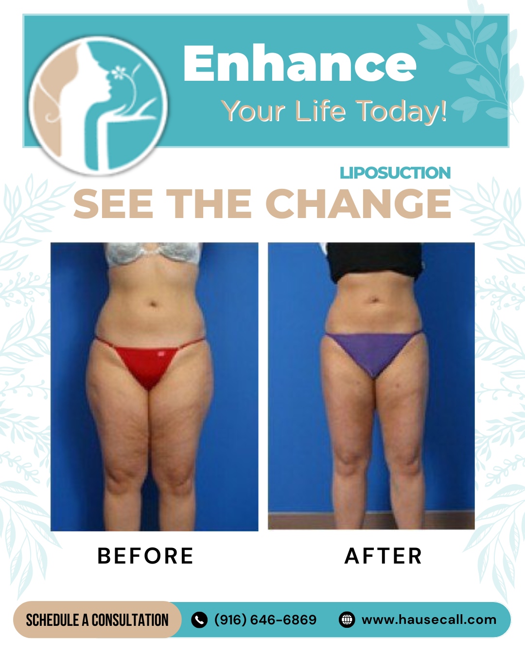 Sacramento Aesthetic Surgery Liposuction Sacramento Aesthetic Surgery Liposuction