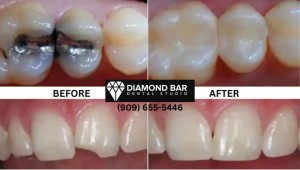 Diamond Bar dental group Diamond Bar CA