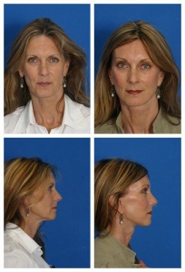 composite 16038897612407 jpg nggid0216 ngg0dyn 300x300x100 00f0w010c010r110f110r010t010