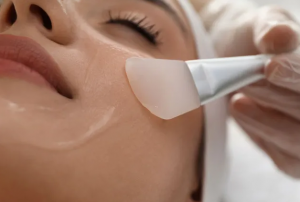 Hydrafacial in Burlington