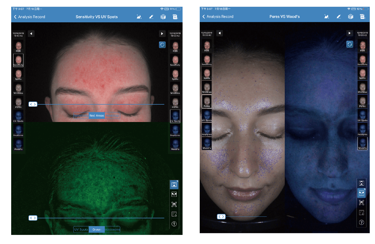 Facial Morphology Analysis Machine