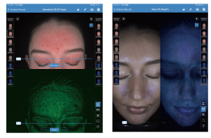 Facial Morphology Analysis Machine
