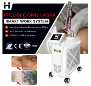 Pico Laser Solution for Tattoo and Pigment Removal