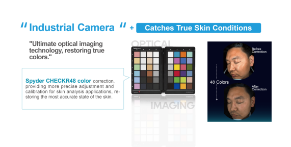 Professional Skin Analyzer