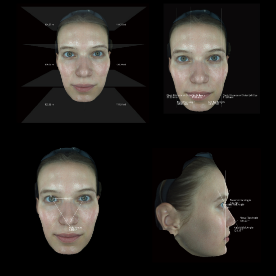 Leading Skin Analyzer Partner