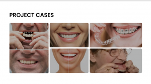 Sunflower Dental Lab