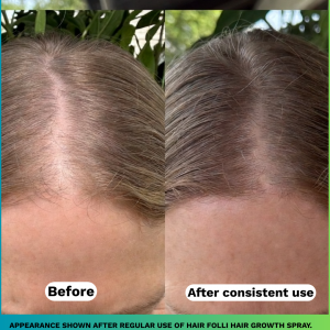 Visible scalp improvement with consistent scalp-focused care