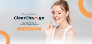 clearchangealigners1