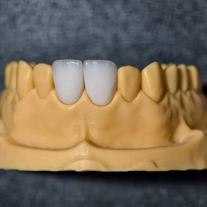 Sunflower Dental Lab Product Portfolio Where Artistry Meets Engineering