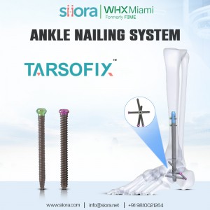 TARSOFIX Ankle Nailing System siora surgicals