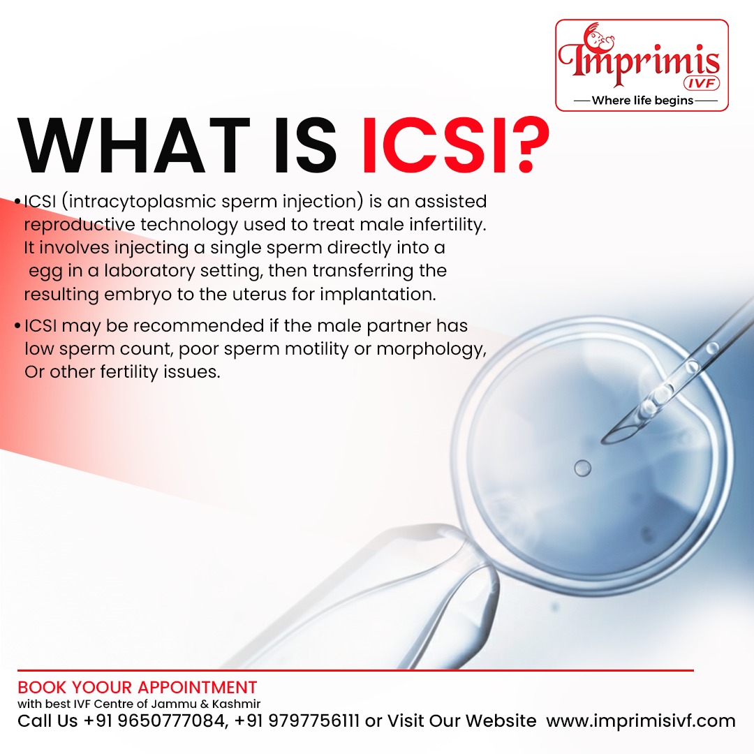 ICSI Treatment