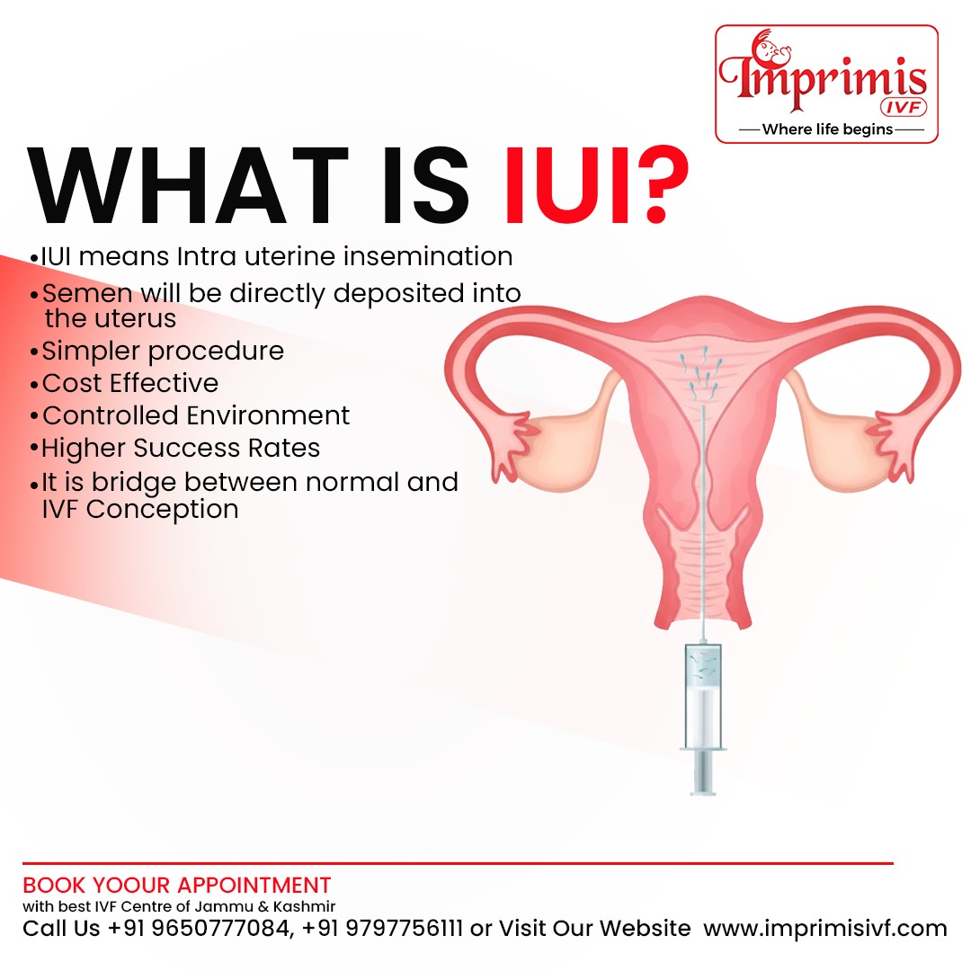 IUI Treatment