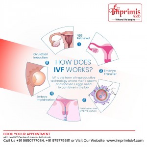 IVF Stages