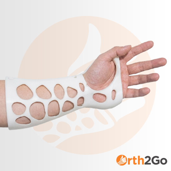 Short Arm Cast Image