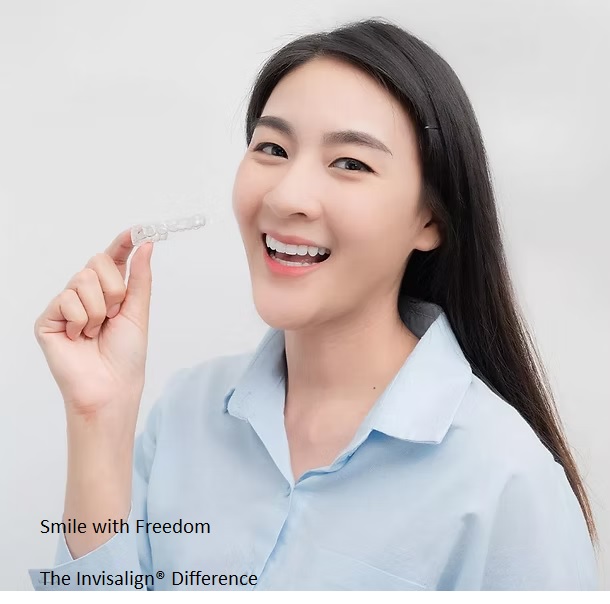 The Invisalign The Invisalign