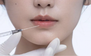 Reliable Skin Mesotherapy Solutions Provider