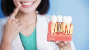 best dental specialist trivandrum dental implant rysa clinic