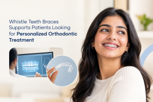 Personalized teeth braces treatment designed around every patient’s unique smile.