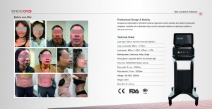 What to Evaluate in Advanced Acne Scar Remodeling in Aesthetic Practice: ENDO ONE’s Energy Delivery and Tissue Targeting