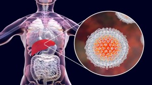 Hepatitis Drugs Market Is Growing Due to Increasing R&D Investments on Hepatitis Research and Drug Discovery