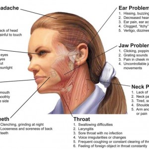 TMJ Specialist Los Angeles Dr. Jacob Elisha