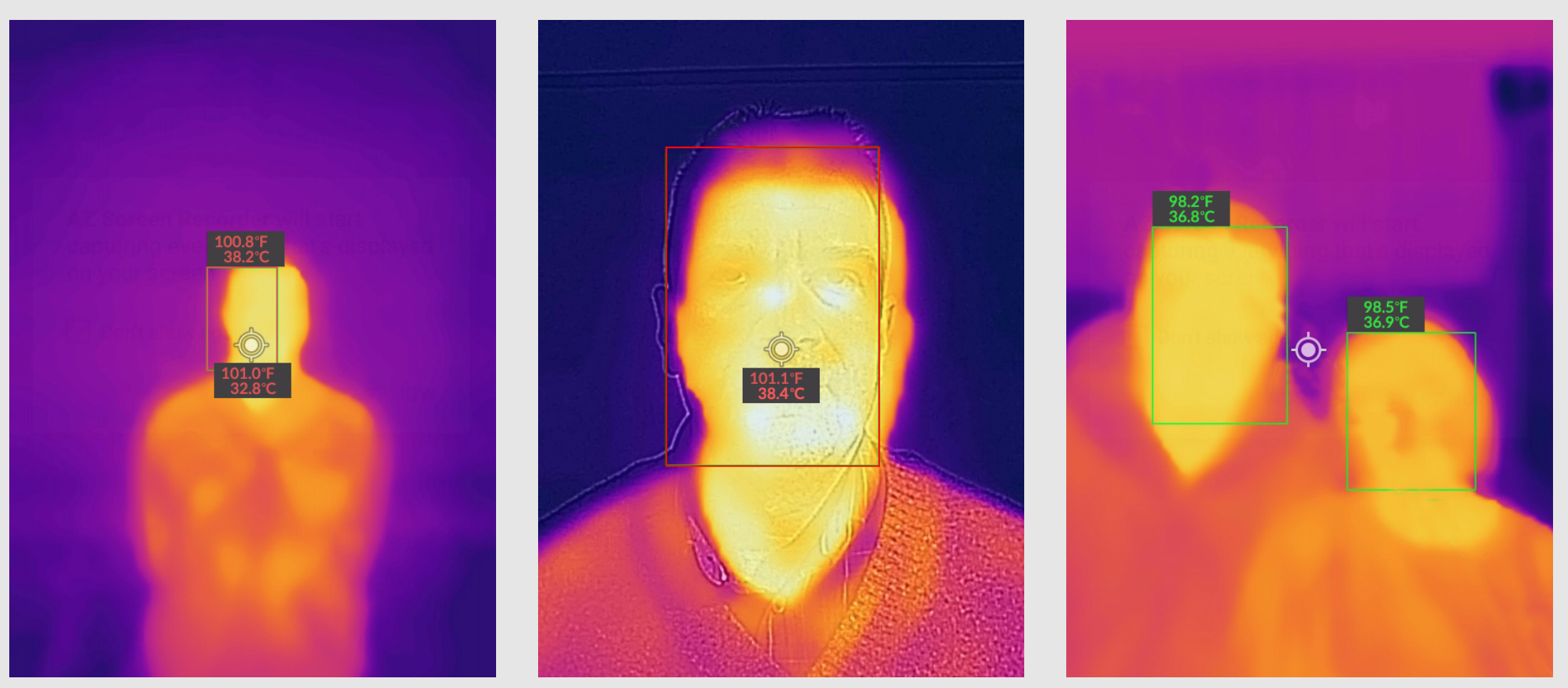 Thermography Detection