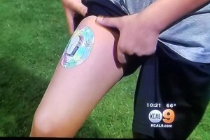 Type 1 Diabetes Discrimination Alleged Against Under Armour & Riverside Under the Lights Flag Football