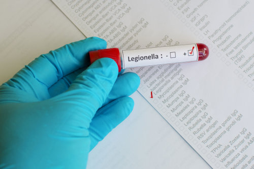 Legionella Risk Assessment Service Legionella Risk Assessment Service