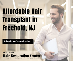 Affordable Hair Transplant in Freehold, NJ