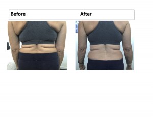 Your Posture May Be Making You Fat