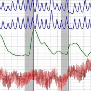 Polygraph Test Los Angeles chart