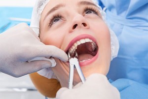 emergency tooth extraction