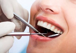 tooth extraction