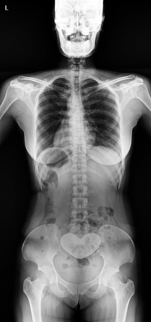 Longtail DR PACS image 1