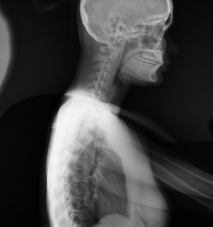 Longtail DR PACS image 2