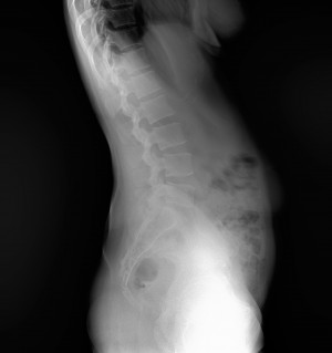 Longtail DR PACS Image 3