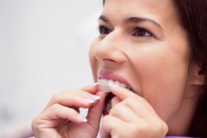 Invisalign Braces