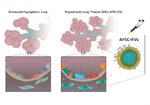 Exosomes from amniotic fluid stem cells in animal models and human lung cells to treat lungs.