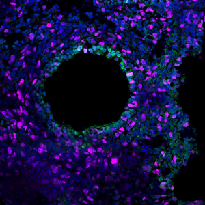 Exosomes from amniotic fluid stem cells in animal models and human lung cells to treat lungs.