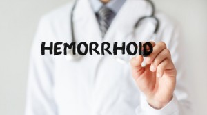 hemorrhoid treatment