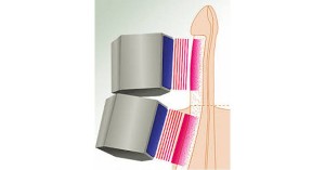 96227e9a7fc1f230b68e0cd0b9f85038 Erectile Dysfunction Treatment min