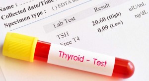 Thyroid Function Test Market