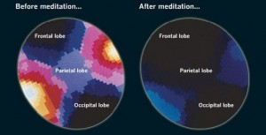 Neuroscience can use some meditative techniques 