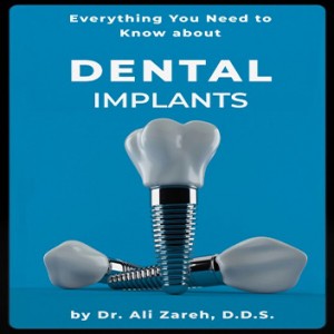 Dental Views Releases Insightful Book on Dental Implants