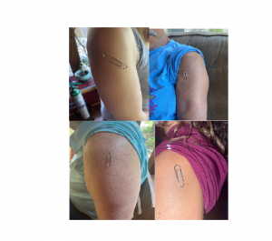 Demonstration of non-magnetized paper clip attachment to the skin on 4 Subjects