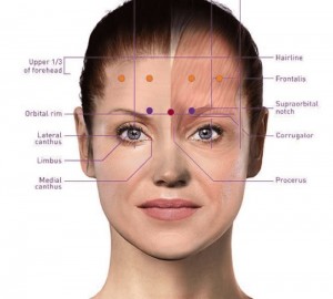 Botox